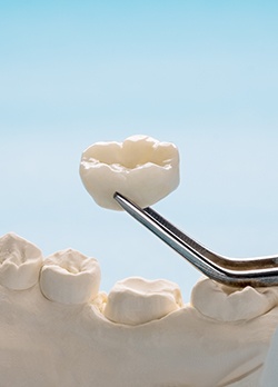 Metal instrument lifting dental crown in Enterprise, OR off model of teeth