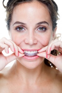 Cosmetic dentistry in Enterprise can help straighten your teeth with MTM clear aligners.