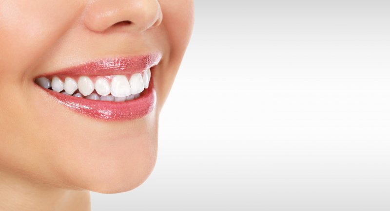 woman smiling with dental crowns or dental fillings